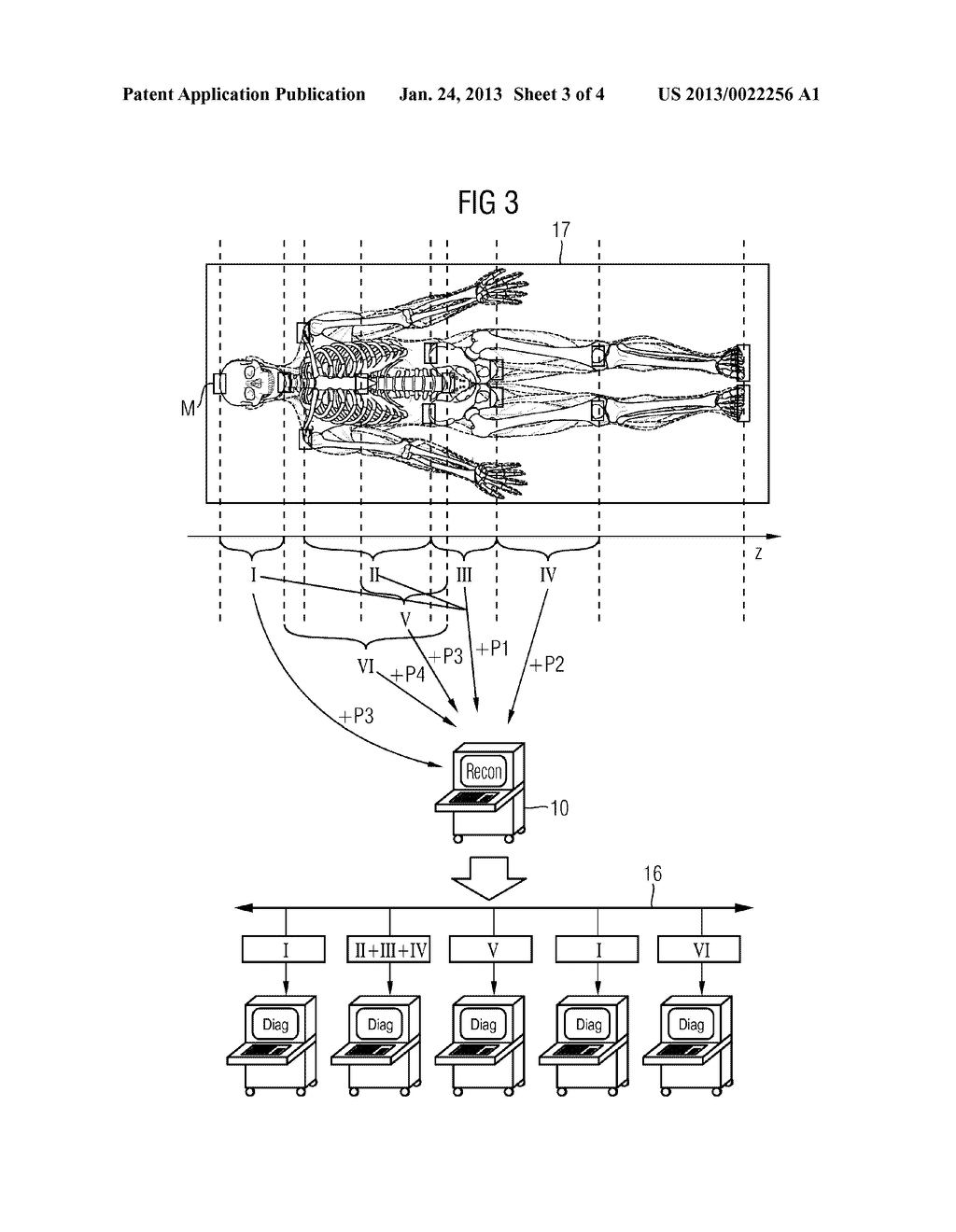 METHOD AND CT SYSTEM FOR RECORDING AND DISTRIBUTING WHOLE-BODY CT DATA OF     A POLYTRAUMATIZED PATIENT - diagram, schematic, and image 04