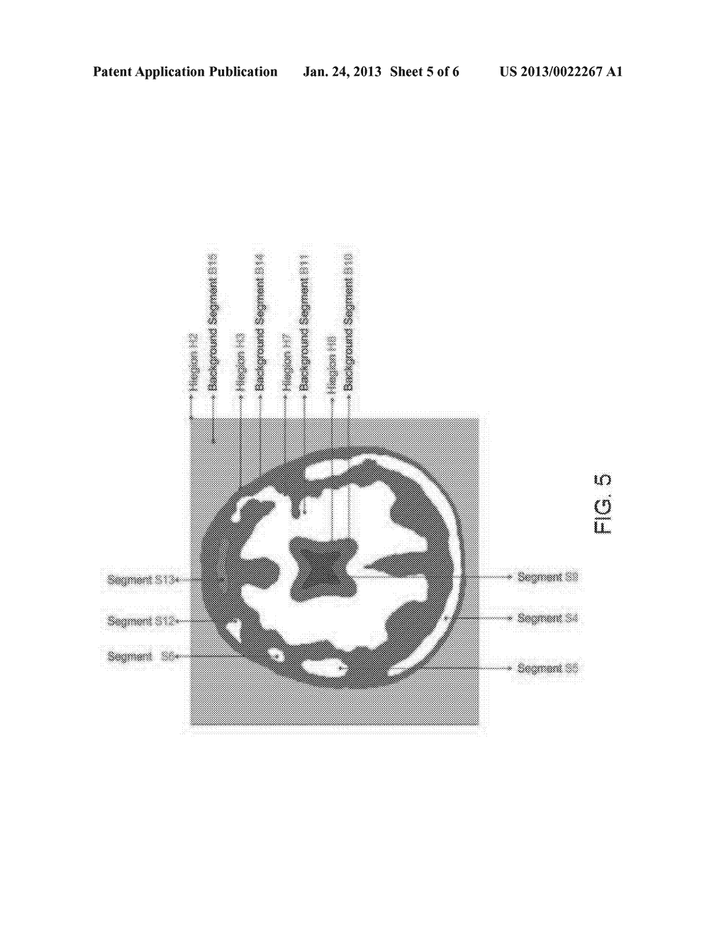 SYSTEM AND METHOD FOR MODELING A REGION SEGMENTED IMAGE - diagram, schematic, and image 06