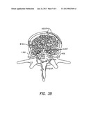 METHODS TO FACILITATE TRANSMISSION OF LARGE MOLECULES ACROSS THE     BLOOD-BRAIN, BLOOD-EYE, AND BLOOD-NERVE BARRIERS diagram and image