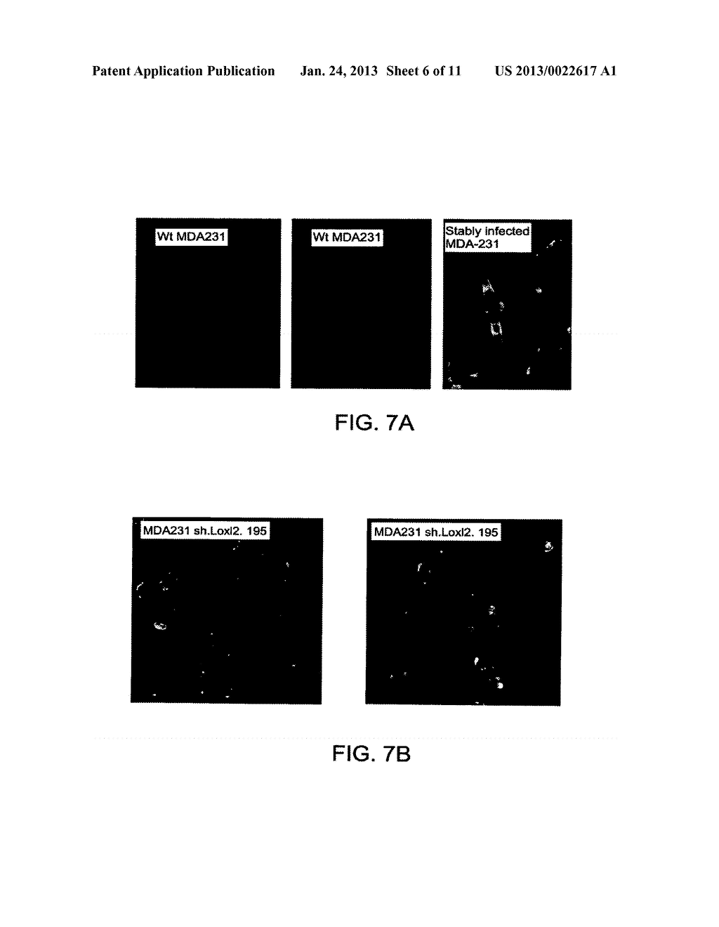 COMPOSITIONS AND METHODS FOR TREATING TUMORS, FIBROSIS, AND PULMONARY     ALVEOLAR PROTEINOSIS - diagram, schematic, and image 07