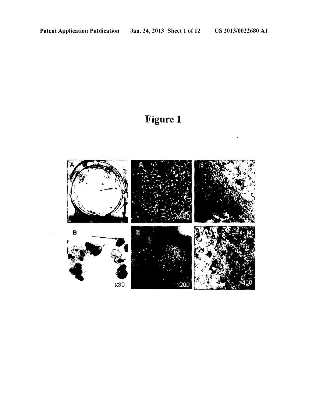 Modalities for the treatment of degenerative diseases of the retina - diagram, schematic, and image 02