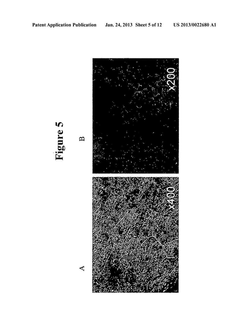 Modalities for the treatment of degenerative diseases of the retina - diagram, schematic, and image 06