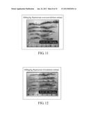 METHOD FOR TREATING OR RELIEVING INFLAMMATORY BOWEL DISEASE diagram and image