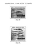 METHOD FOR TREATING OR RELIEVING INFLAMMATORY BOWEL DISEASE diagram and image