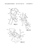 DENTAL PLIER DESIGN WITH OFFSETTING JAW AND PAD ELEMENTS FOR ASSISTING IN     REMOVING UPPER AND LOWER TEETH UTILIZING THE DENTAL PLIER DESIGN diagram and image