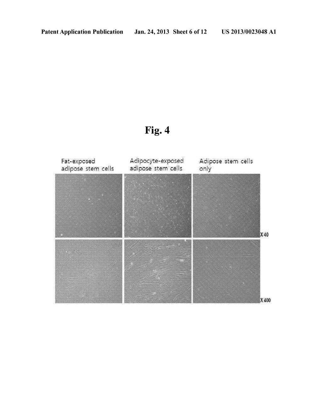 Method of Inducing High Activity of Human Adipose Stem Cell and Medium     Therefor - diagram, schematic, and image 07