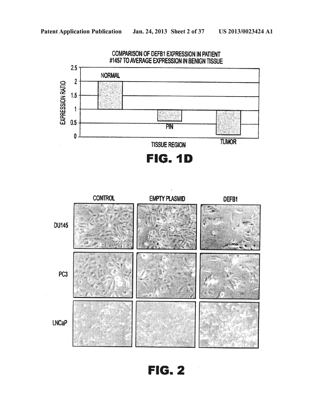 DETECTING PAX2 FOR THE DIAGNOSIS OF BREAST CANCER - diagram, schematic, and image 03