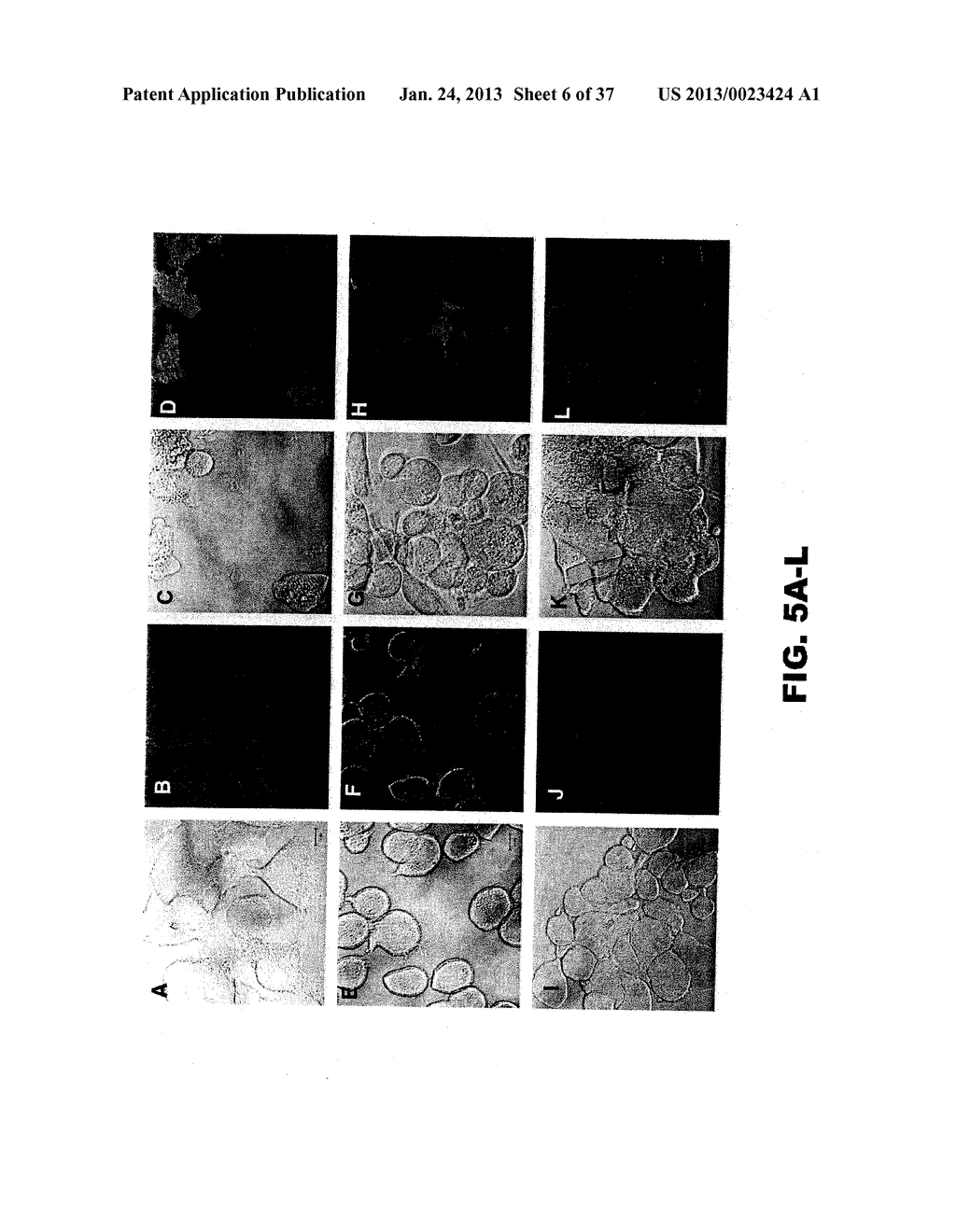 DETECTING PAX2 FOR THE DIAGNOSIS OF BREAST CANCER - diagram, schematic, and image 07