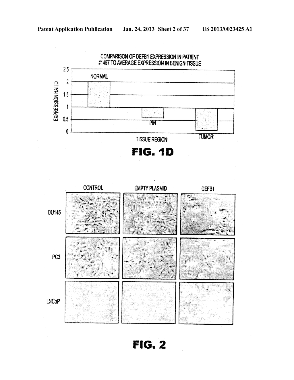 DETECTING PAX2 FOR THE DIAGNOSIS OF BREAST CANCER - diagram, schematic, and image 03