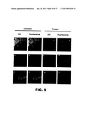 DETECTING PAX2 FOR THE DIAGNOSIS OF BREAST CANCER diagram and image