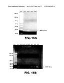 DETECTING PAX2 FOR THE DIAGNOSIS OF BREAST CANCER diagram and image