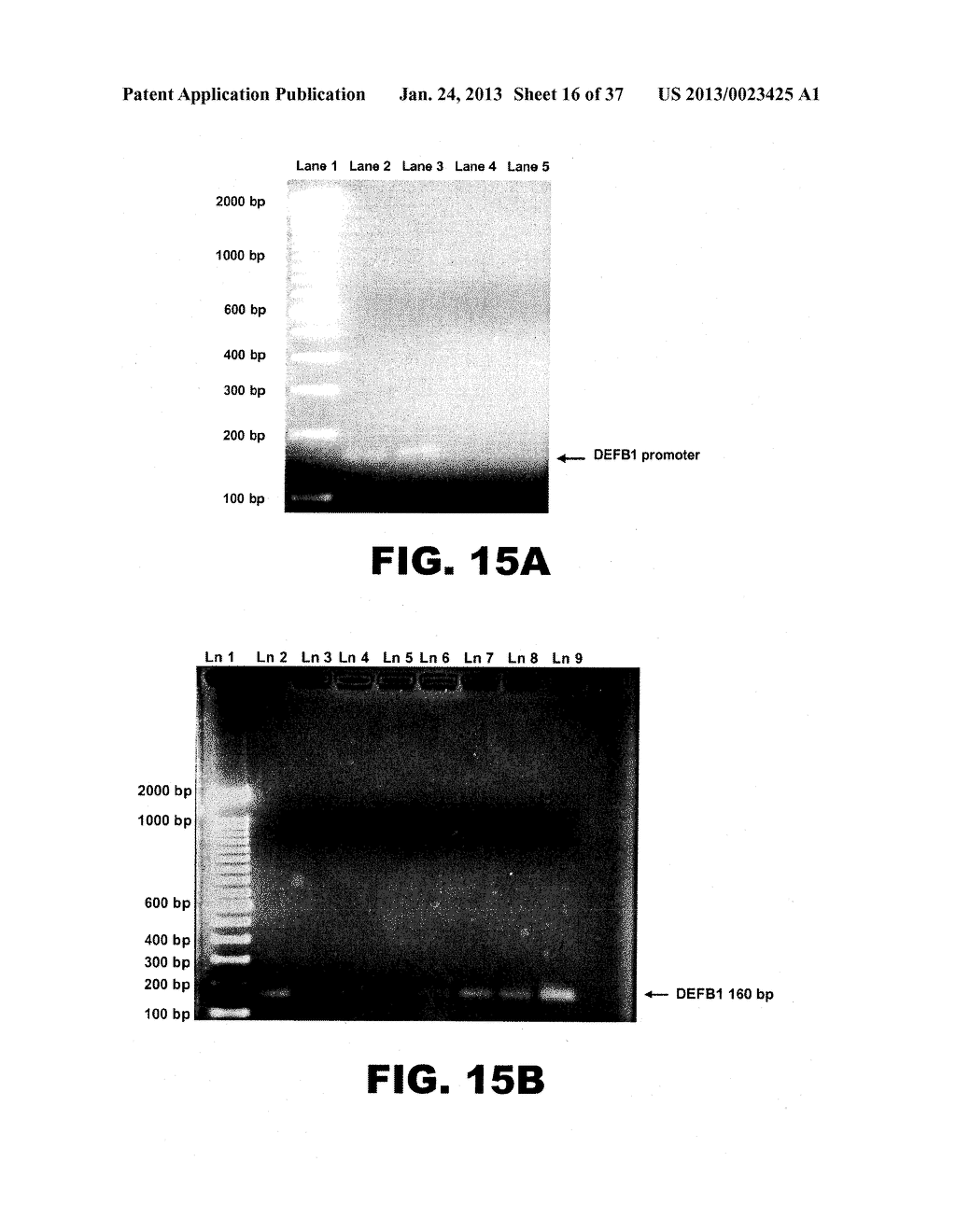 DETECTING PAX2 FOR THE DIAGNOSIS OF BREAST CANCER - diagram, schematic, and image 17