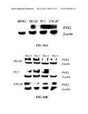 DETECTING PAX2 FOR THE DIAGNOSIS OF BREAST CANCER diagram and image