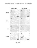 DETECTING PAX2 FOR THE DIAGNOSIS OF BREAST CANCER diagram and image