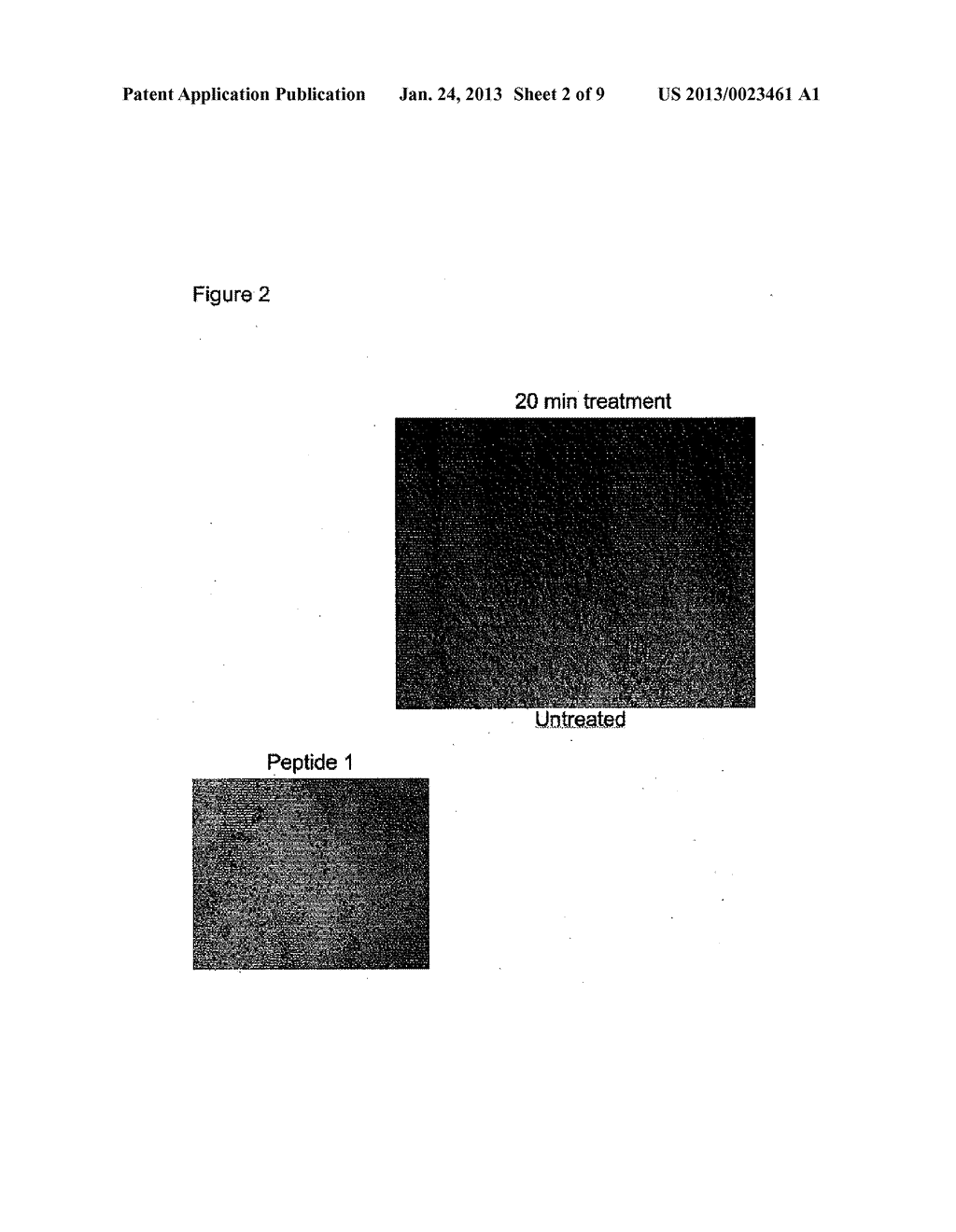 OLIGOPEPTIDE COMPOUNDS AND USES THEREOF - diagram, schematic, and image 03