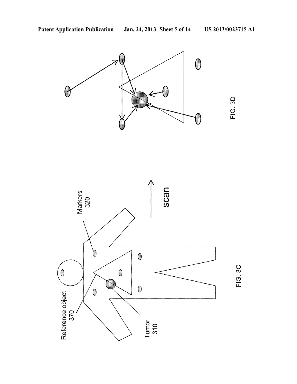 TRACKING OF TUMOR LOCATION FOR TARGETED RADIATION TREATMENT - diagram, schematic, and image 06