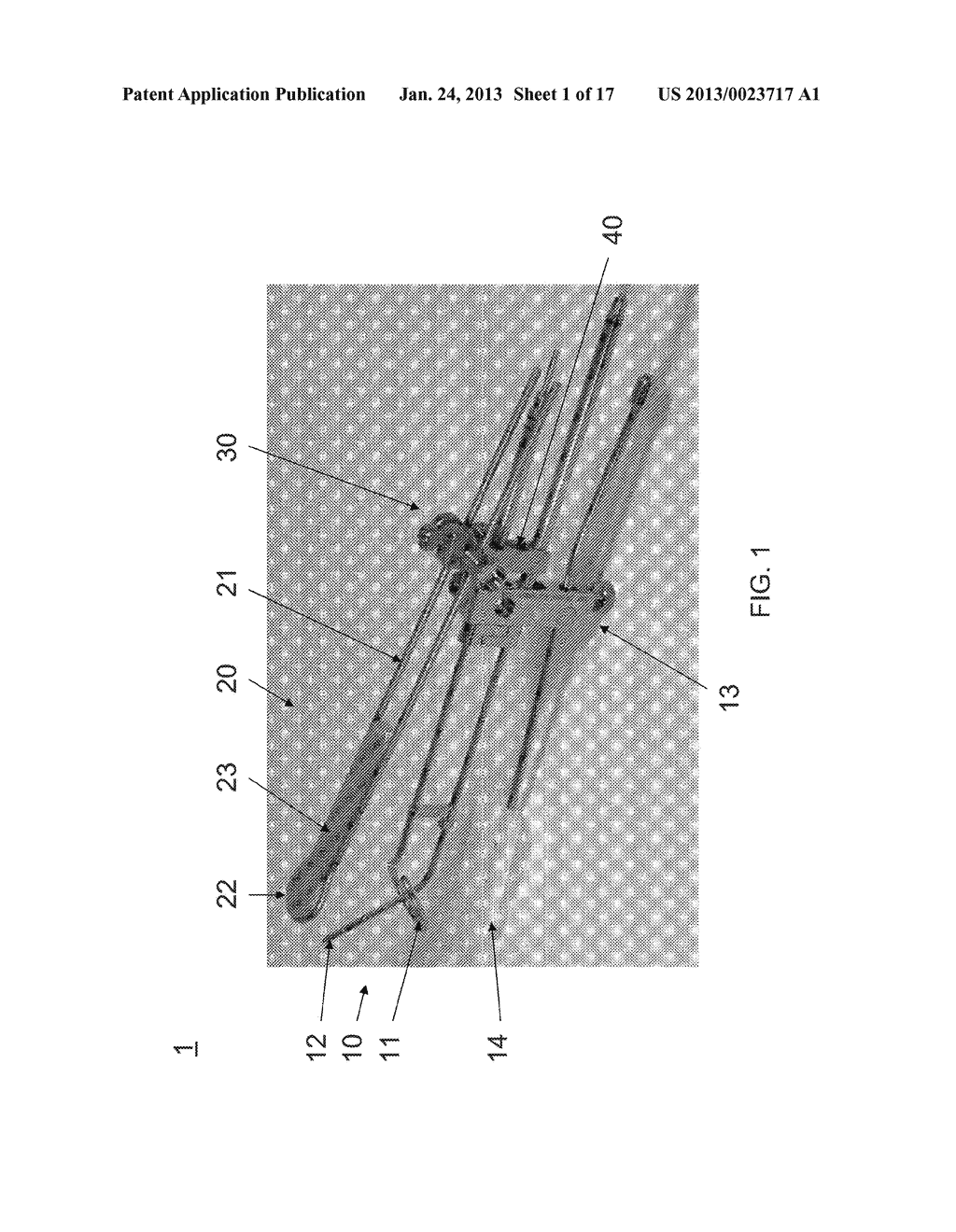 Bladder and/or Rectum Extender with Exchangeable and/or Slideable Tungsten     Shield - diagram, schematic, and image 02