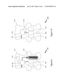 TACTILE USER DEVICES AND METHODS diagram and image