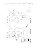 TACTILE USER DEVICES AND METHODS diagram and image