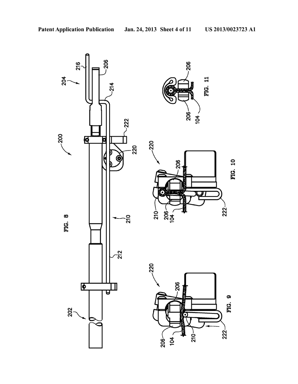 SYSTEMS AND METHODS FOR TREATMENT OF FECAL INCONTINENCE - diagram, schematic, and image 05