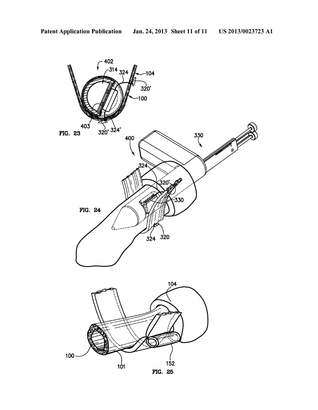 SYSTEMS AND METHODS FOR TREATMENT OF FECAL INCONTINENCE - diagram, schematic, and image 12