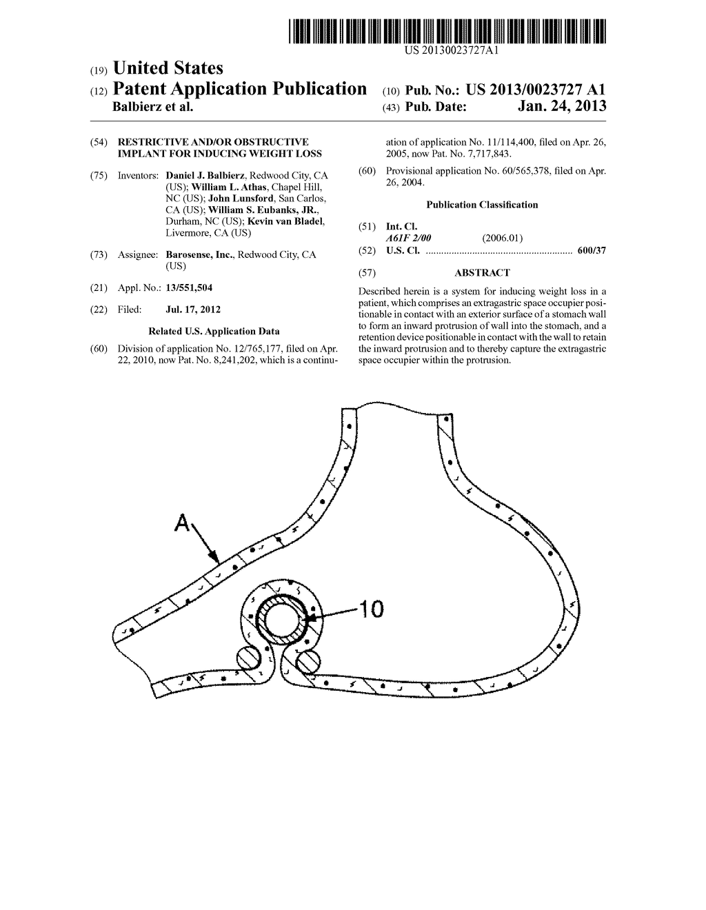 RESTRICTIVE AND/OR OBSTRUCTIVE IMPLANT FOR INDUCING WEIGHT LOSS - diagram, schematic, and image 01