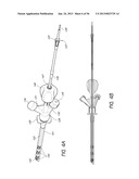 AIRWAY CLEANING AND VISUALIZATION diagram and image