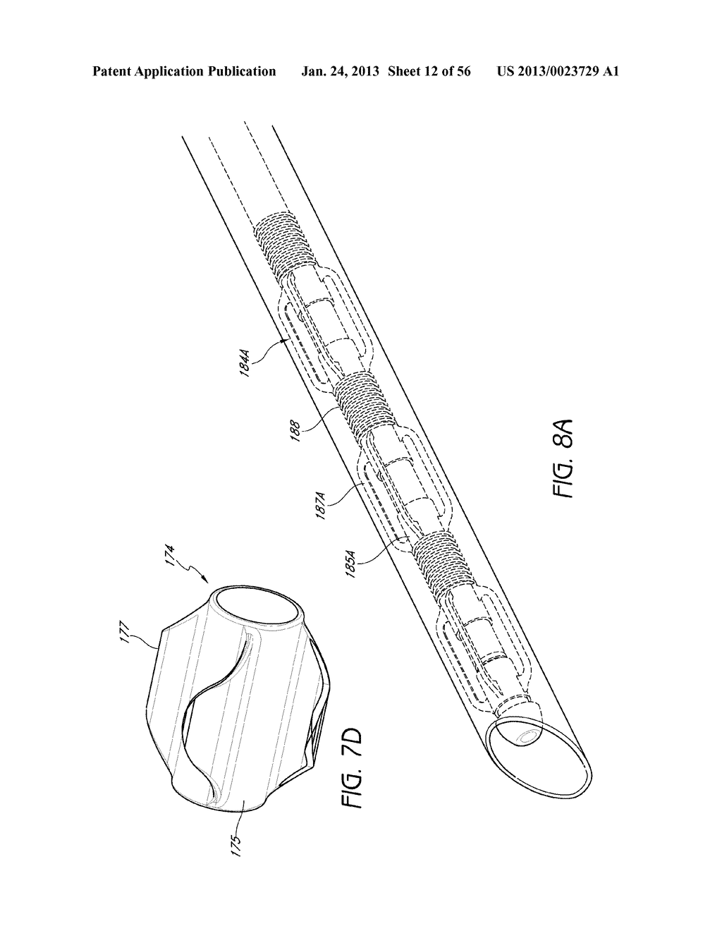 AIRWAY CLEANING AND VISUALIZATION - diagram, schematic, and image 13