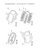 AIRWAY CLEANING AND VISUALIZATION diagram and image