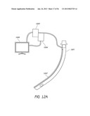 AIRWAY CLEANING AND VISUALIZATION diagram and image