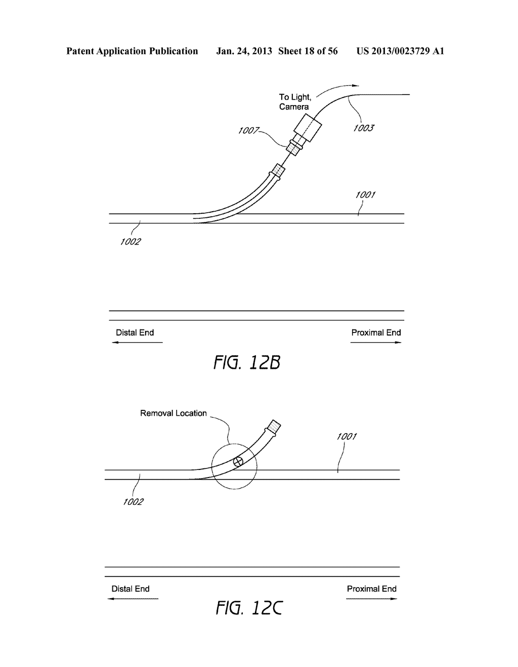 AIRWAY CLEANING AND VISUALIZATION - diagram, schematic, and image 19