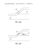 AIRWAY CLEANING AND VISUALIZATION diagram and image