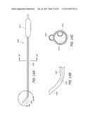 AIRWAY CLEANING AND VISUALIZATION diagram and image