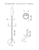 AIRWAY CLEANING AND VISUALIZATION diagram and image