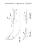 AIRWAY CLEANING AND VISUALIZATION diagram and image