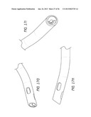 AIRWAY CLEANING AND VISUALIZATION diagram and image