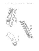 AIRWAY CLEANING AND VISUALIZATION diagram and image