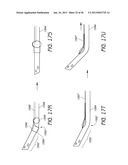 AIRWAY CLEANING AND VISUALIZATION diagram and image