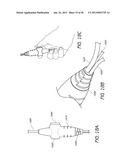 AIRWAY CLEANING AND VISUALIZATION diagram and image