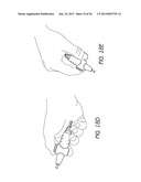 AIRWAY CLEANING AND VISUALIZATION diagram and image