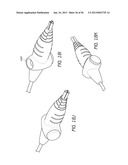 AIRWAY CLEANING AND VISUALIZATION diagram and image