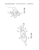 AIRWAY CLEANING AND VISUALIZATION diagram and image