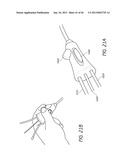 AIRWAY CLEANING AND VISUALIZATION diagram and image