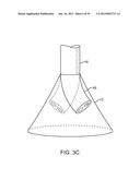 TISSUE VISUALIZATION DEVICE AND METHOD VARIATIONS diagram and image