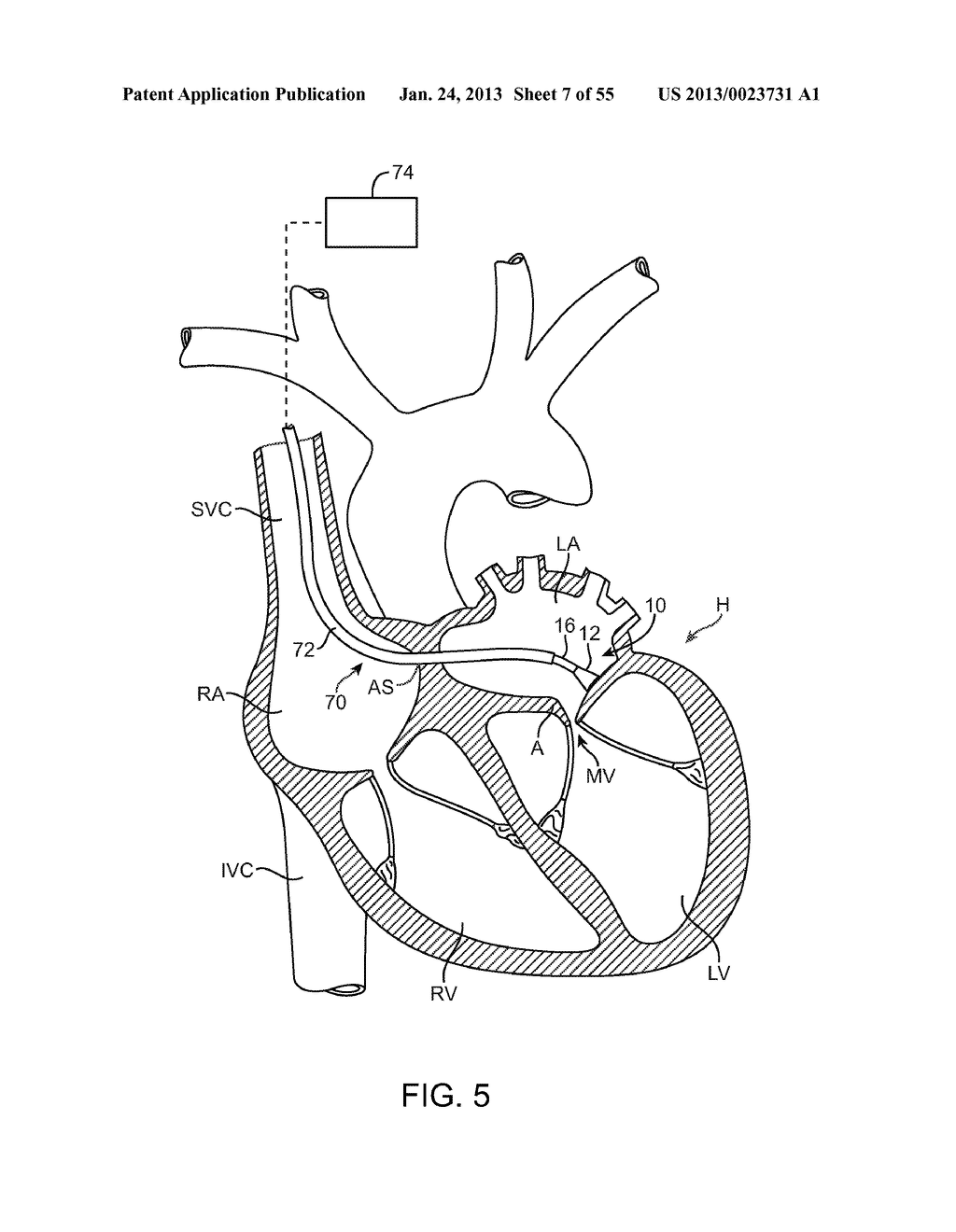 TISSUE VISUALIZATION DEVICE AND METHOD VARIATIONS - diagram, schematic, and image 08