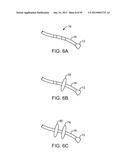 TISSUE VISUALIZATION DEVICE AND METHOD VARIATIONS diagram and image