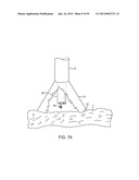 TISSUE VISUALIZATION DEVICE AND METHOD VARIATIONS diagram and image