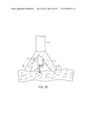 TISSUE VISUALIZATION DEVICE AND METHOD VARIATIONS diagram and image