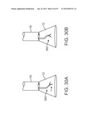 TISSUE VISUALIZATION DEVICE AND METHOD VARIATIONS diagram and image