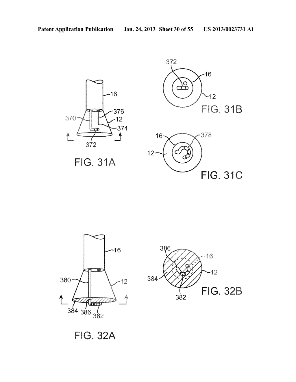 TISSUE VISUALIZATION DEVICE AND METHOD VARIATIONS - diagram, schematic, and image 31